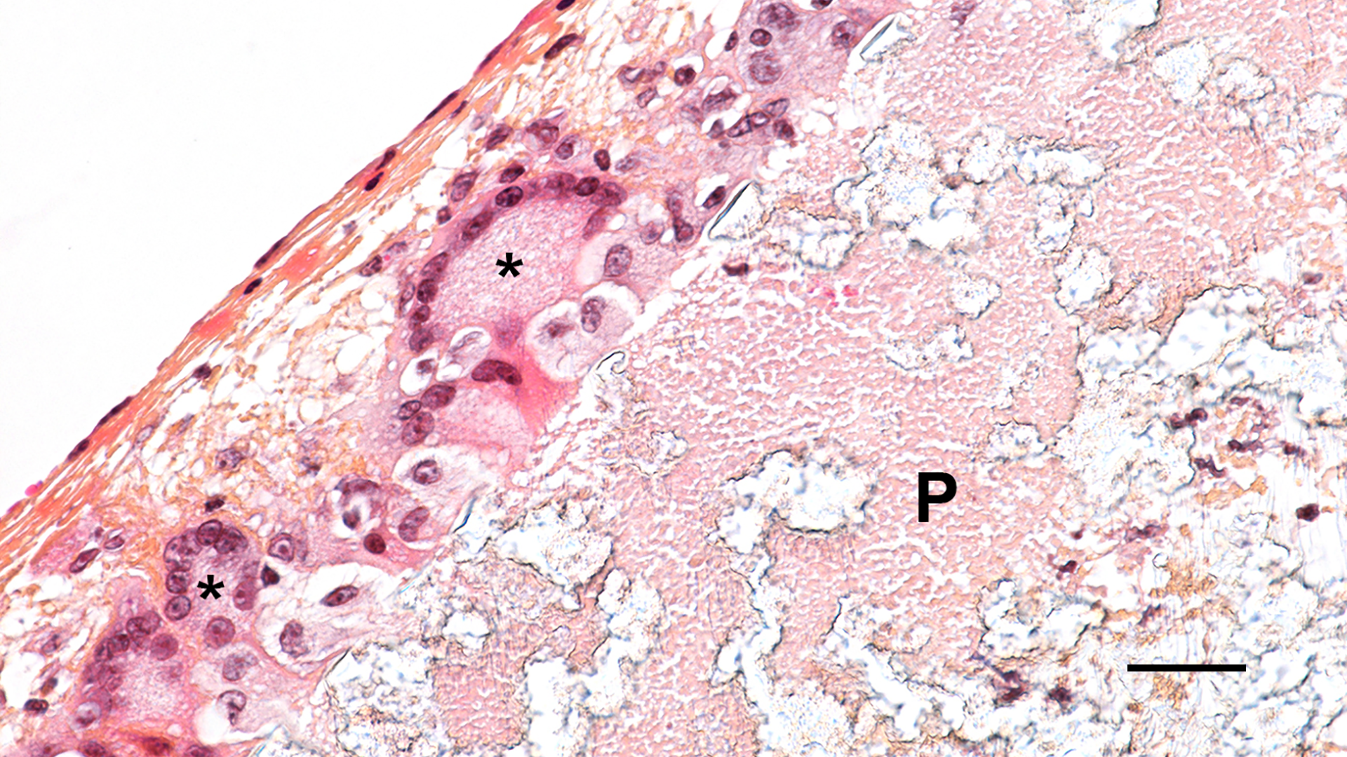 immr - Giant-cells immr - Giant-cells