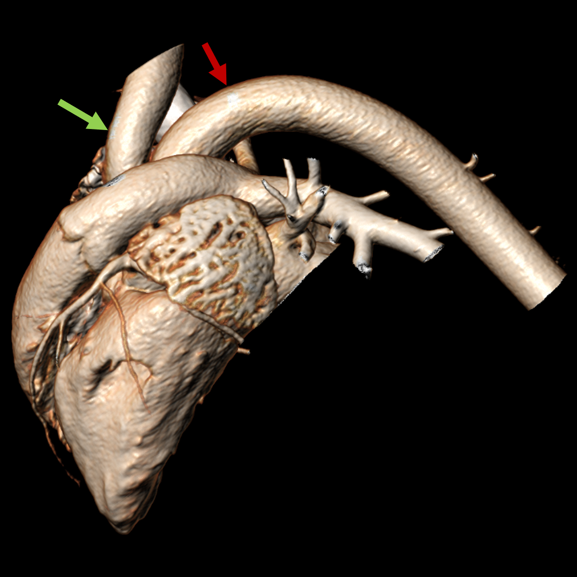 IOTW16 Aortic arch Sheep-c