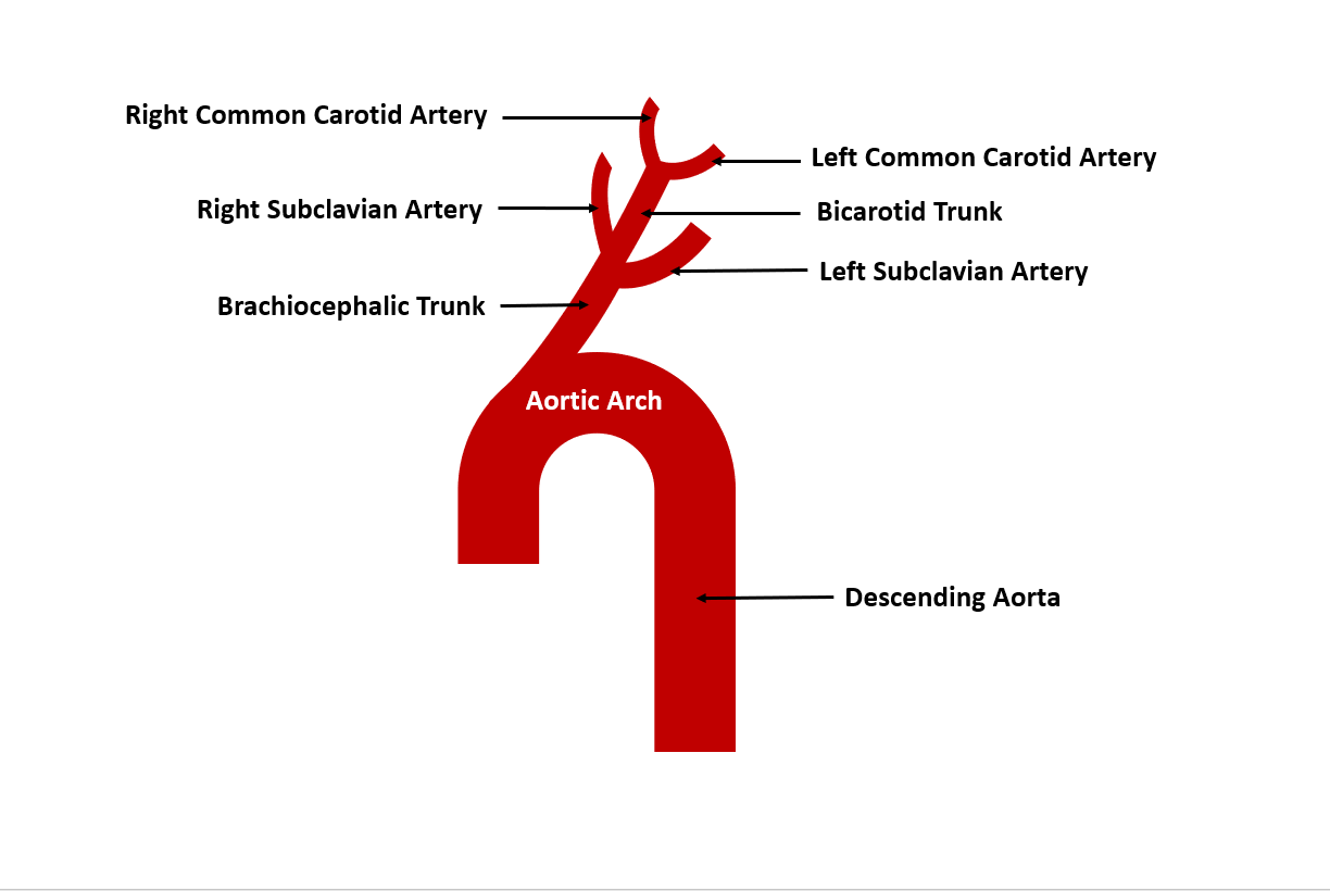 IOTW16 Drawing Aortic arch Sheep
