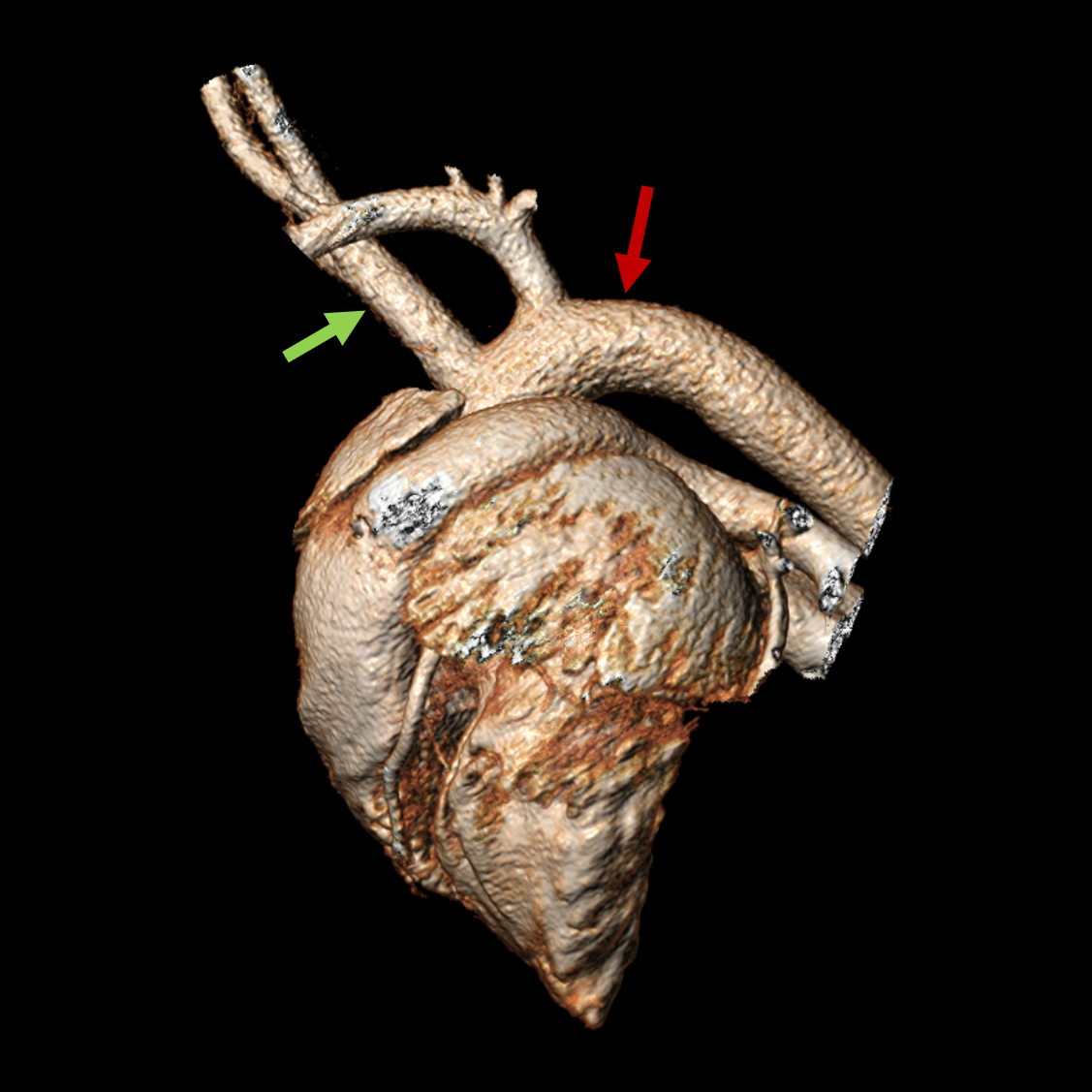 IOTW17 Aortic arch Pig-c