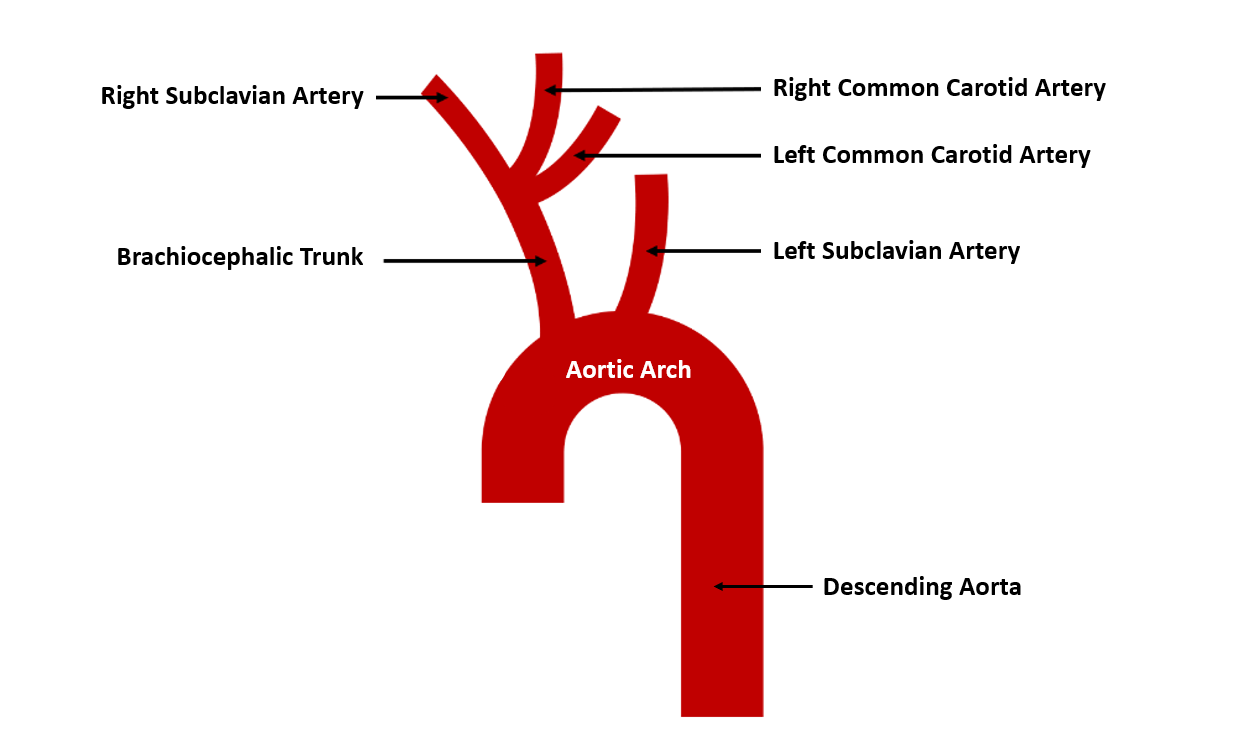 IOTW17 Drawing Aortic arch Pig