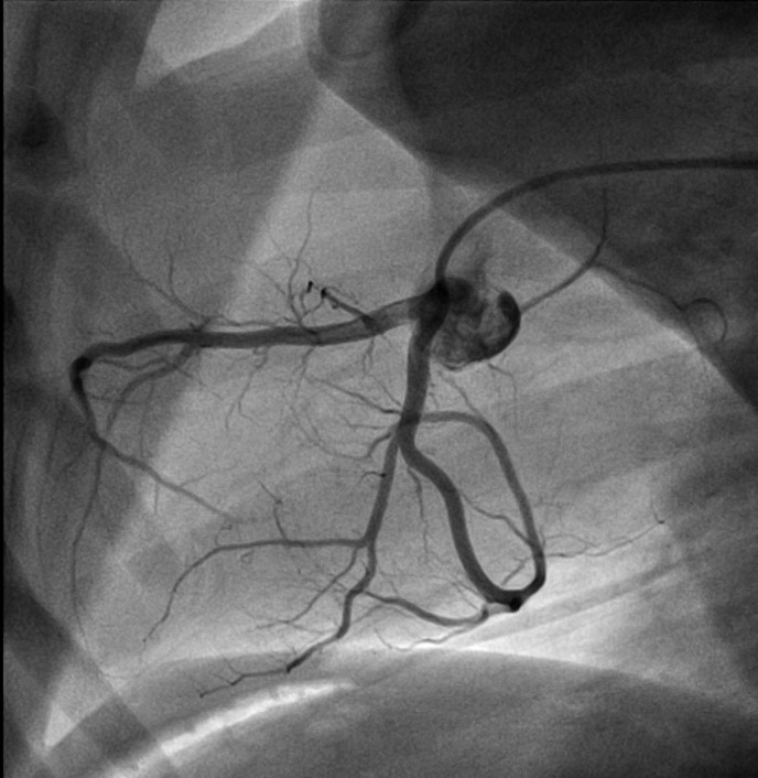 Image N26_Ovine left coronary angiogram